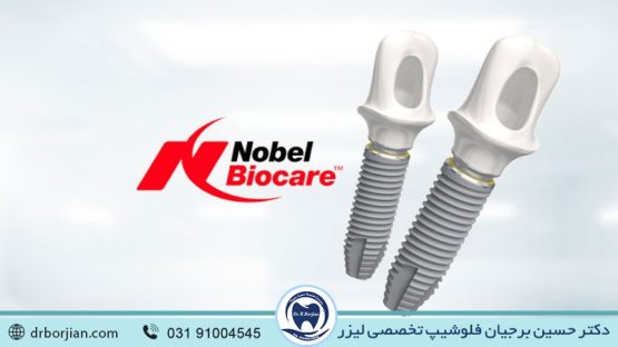 بهترین ایمپلنت اصفهان | ایمپلنت دندان سوئیسی در اصفهان | ایمپلنت دندان سوئیسی نوبل بیوکر | ایمپلنت دندان سوئیسی در اصفهان