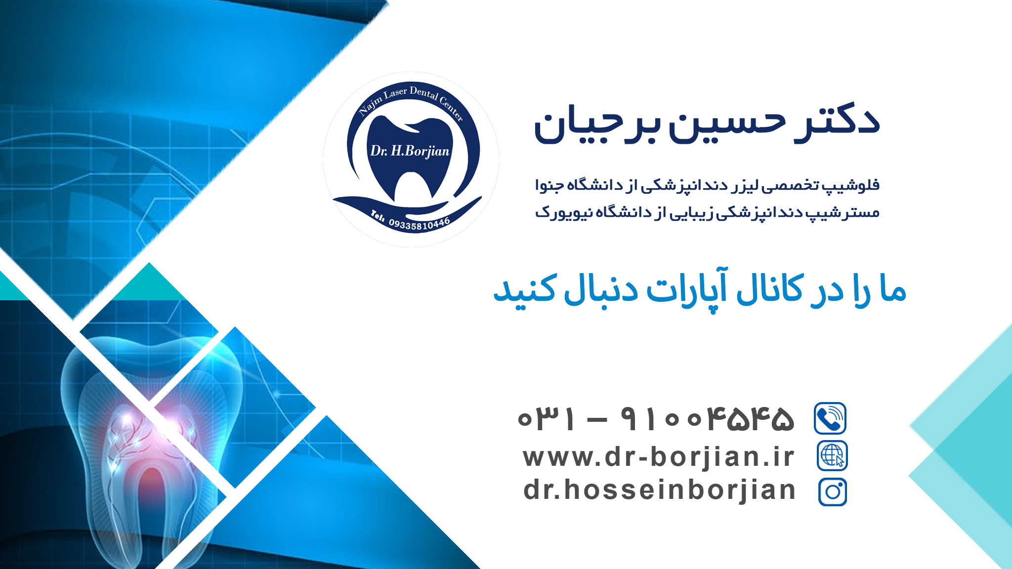 رعایت بهداشت ایمپلنت | متخصص ایمپلنت اصفهان