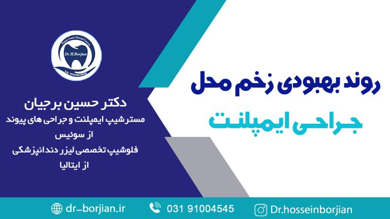 کلیپ آپارات روند بهبودی زخم محل جراحی ایمپلنت|متخصص ایمپلنت اصفهان