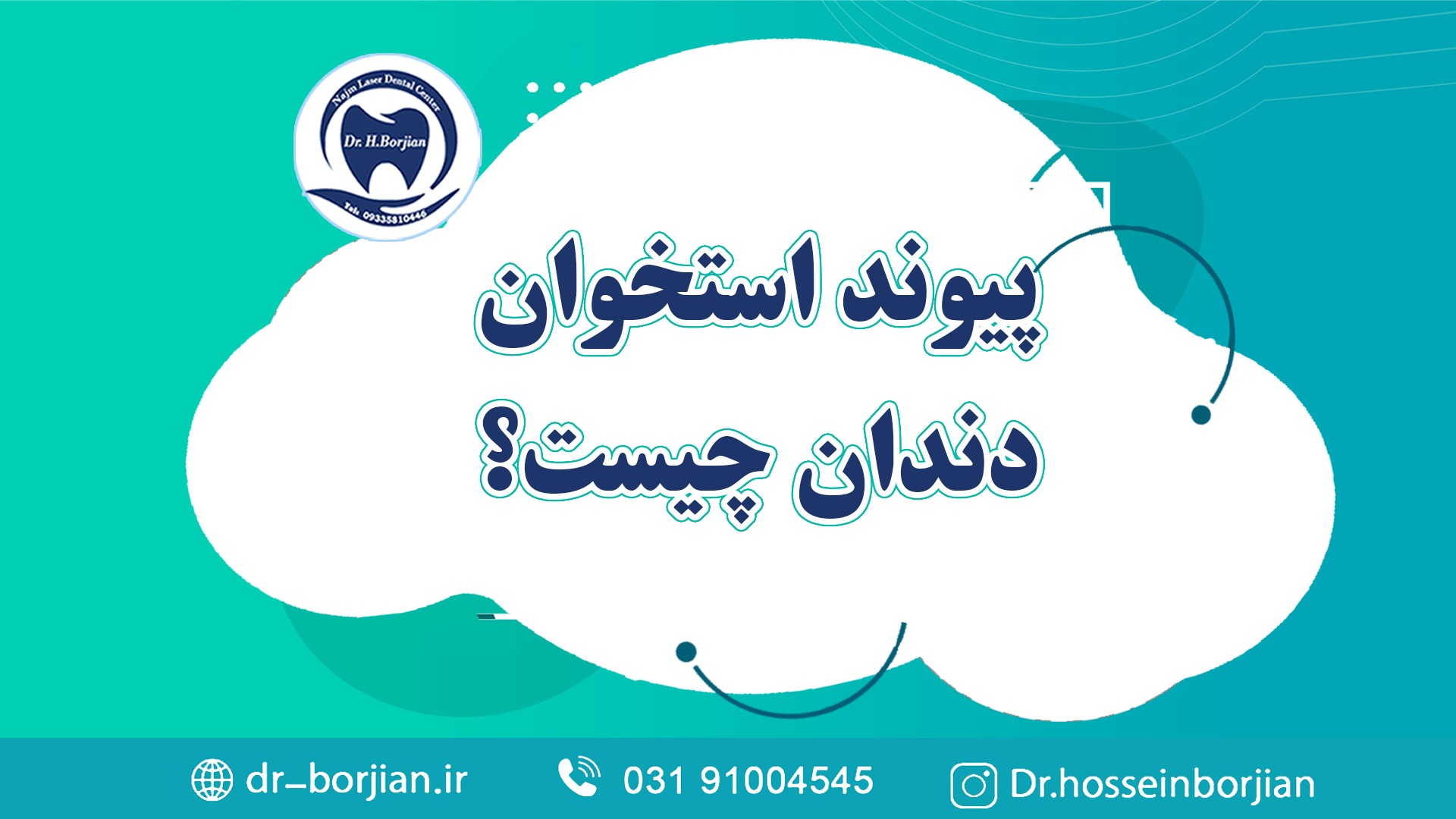 کلیپ آپارات پیوند استخوان دندان چیست|متخصص ایمپلنت اصفهان