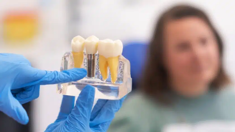 بهترین ایمپلنت اصفهان | ایمپلنت دندان سوئیسی در اصفهان | عوارض طولانی مدت کاشت ایمپلنت دندان را بشناسید :