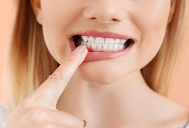 ضرورت داشتن لثه سالم برای کاشت ایمپلنت دندان