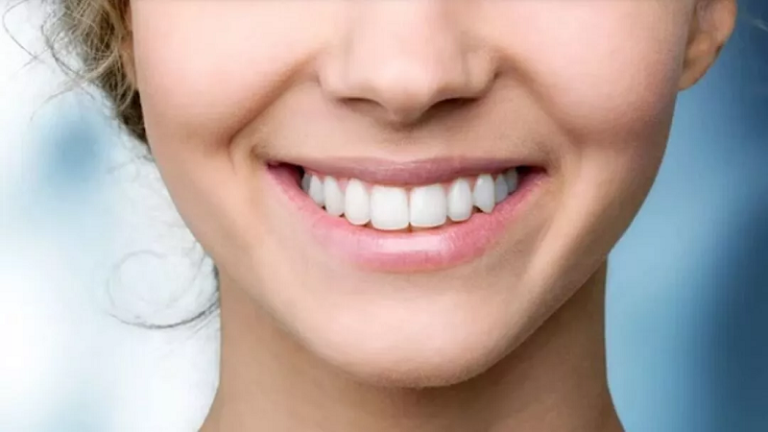 قیمت ایمپلنت اصفهان | بهترین ایمپلنت اصفهان | ایمپلنت دندان سوئیسی در اصفهان | موفقیت ایمپلنت دندان جلو