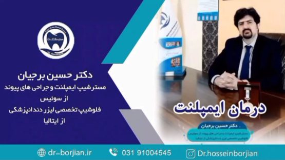 قیمت ایمپلنت اصفهان | بهترین ایمپلنت اصفهان | ایمپلنت دندان سوئیسی در اصفهان | چرا قیمت ایمپلنت در مراکز مختلف متفاوت است؟