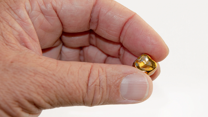 قیمت ایمپلنت اصفهان | بهترین ایمپلنت اصفهان | ایمپلنت دندان سوئیسی در اصفهان |   مد ، دنیای مدرن و ایمپلنت دندان طلا