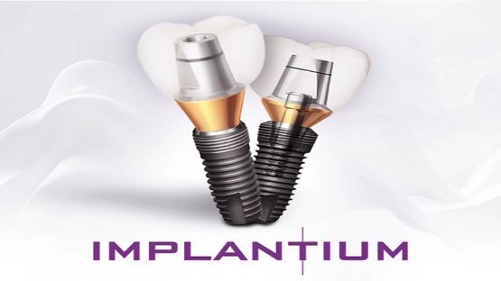 قیمت ایمپلنت اصفهان | بهترین ایمپلنت اصفهان | ایمپلنت دندان سوئیسی در اصفهان | قیمت ایمپلنت ایمپلنتیوم IMPLANTIUM یکی از بهترین پروتزهای دندان کره‌ای