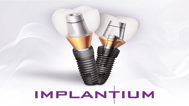 قیمت ایمپلنت اصفهان | بهترین ایمپلنت اصفهان | ایمپلنت دندان سوئیسی در اصفهان | قیمت ایمپلنت ایمپلنتیوم IMPLANTIUM یکی از بهترین پروتزهای دندان کره‌ای