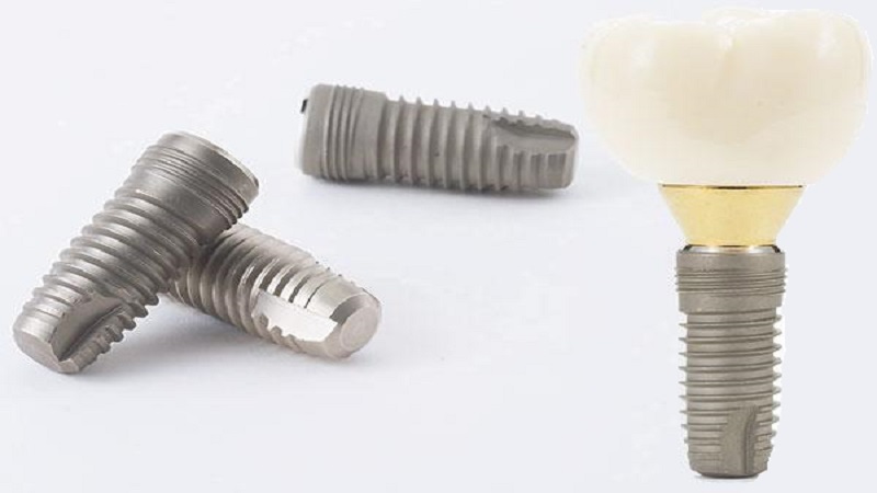 قیمت ایمپلنت اصفهان | بهترین ایمپلنت اصفهان | ایمپلنت دندان سوئیسی در اصفهان | قیمت ایمپلنت ایمپلنتیوم IMPLANTIUM یکی از بهترین پروتزهای دندان کره‌ای