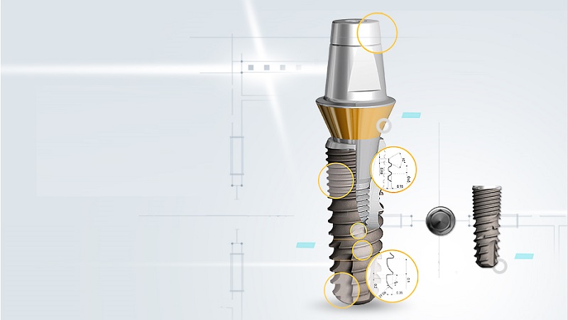 قیمت ایمپلنت اصفهان | بهترین ایمپلنت اصفهان | ایمپلنت دندان سوئیسی در اصفهان | قیمت ایمپلنت دندان کره ای Dentis