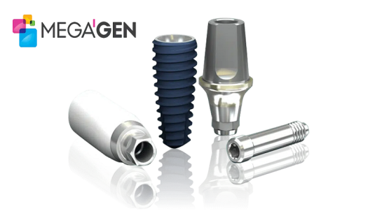 قیمت ایمپلنت اصفهان | بهترین ایمپلنت اصفهان | ایمپلنت دندان سوئیسی در اصفهان | هزینه کاشت ایمپلنت مگاژن چقدر است ؟