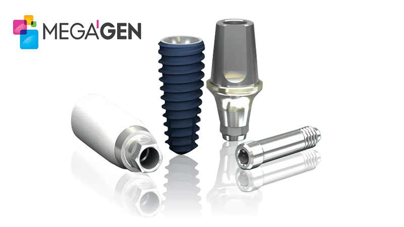 قیمت ایمپلنت اصفهان | بهترین ایمپلنت اصفهان | ایمپلنت دندان سوئیسی در اصفهان | هزینه کاشت ایمپلنت مگاژن چقدر است ؟