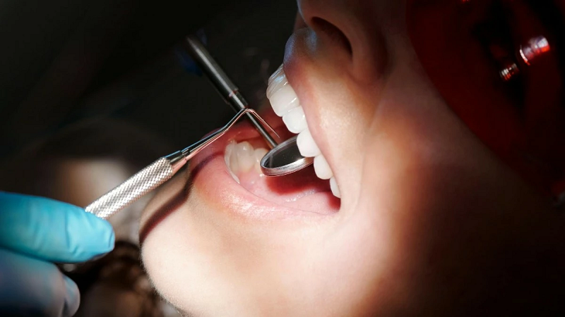 قیمت ایمپلنت اصفهان | بهترین ایمپلنت اصفهان | ایمپلنت دندان سوئیسی در اصفهان | عوارض کوتاه مدت و بلند مدت ایمپلنت دندان و پیشگیری از ان