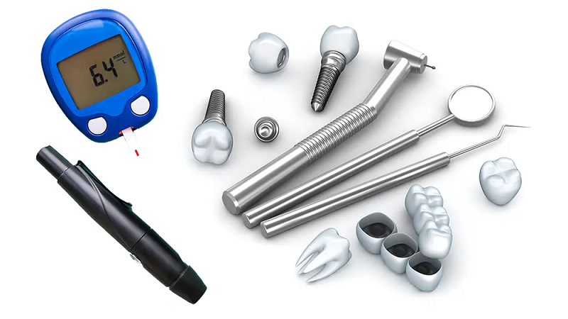 قیمت ایمپلنت اصفهان | بهترین ایمپلنت اصفهان | ایمپلنت دندان سوئیسی در اصفهان | مهم ترین نکات کاشت ایمپلنت دندان در بیماران دیابتی