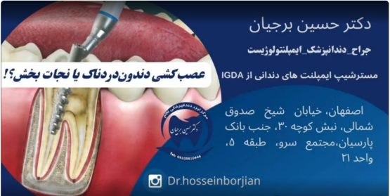 قیمت ایمپلنت اصفهان | بهترین ایمپلنت اصفهان | ایمپلنت دندان سوئیسی در اصفهان | عصب کشی با بهترین متخصص دندانپزشکی اصفهان دکتر حسین برجیان