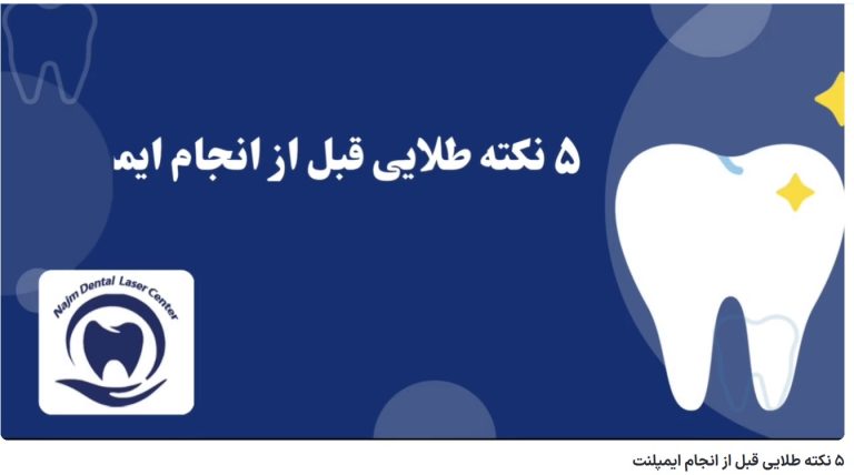 قیمت ایمپلنت اصفهان | بهترین ایمپلنت اصفهان | ایمپلنت دندان سوئیسی در اصفهان | نکته طلایی قبل از انجام ایمپلنت دکتر حسین برجیان، بهترین متخصص ایمپلنت اصفهان، تلفن تماس: 09335810446