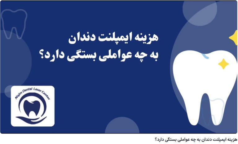 قیمت ایمپلنت اصفهان | بهترین ایمپلنت اصفهان | ایمپلنت دندان سوئیسی در اصفهان | هزینه ایمپلنت دندان به چه عواملی بستگی دارد؟ دکتر حسین برجیان، بهترین متخصص ایمپلنت اصفهان، تلفن تماس: 09335810446