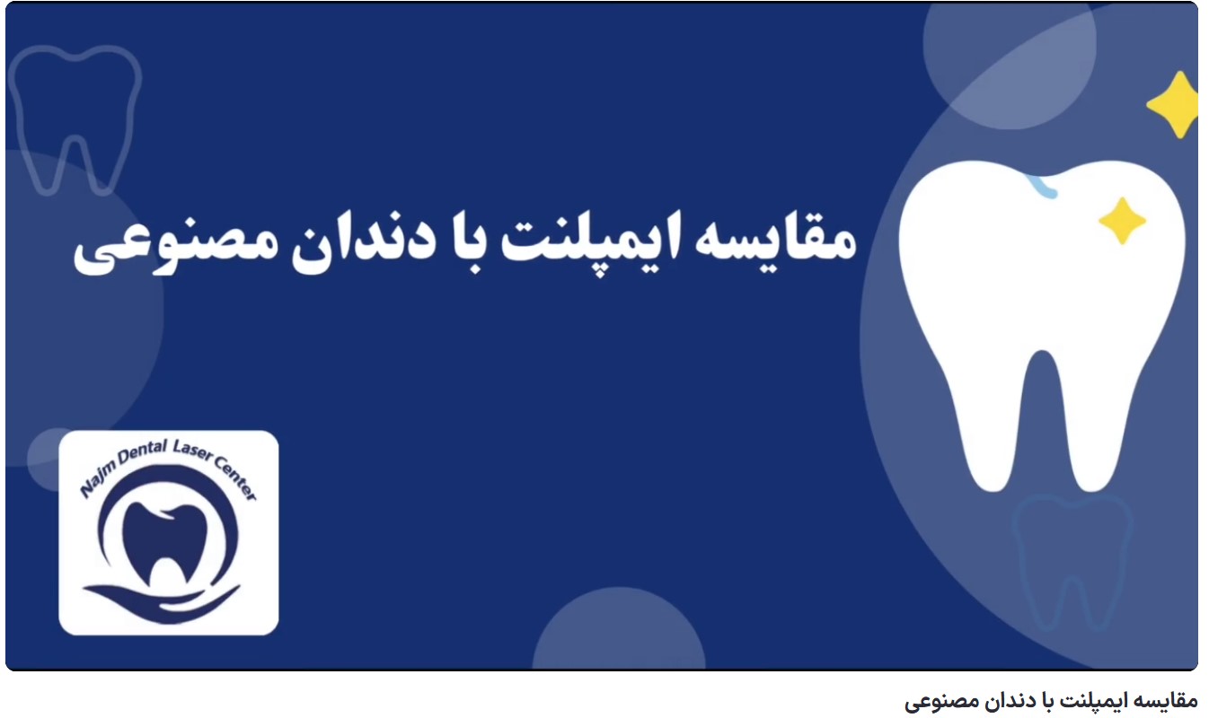 قیمت ایمپلنت اصفهان | بهترین ایمپلنت اصفهان | ایمپلنت دندان سوئیسی در اصفهان | مقایسه ایمپلنت با دندان مصنوعی دکتر حسین برجیان، بهترین متخصص ایمپلنت اصفهان،تلفن تماس: 09138690321