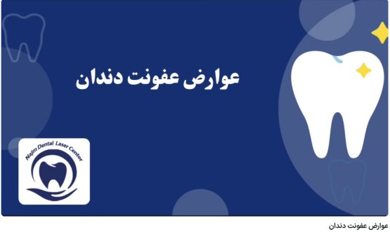 قیمت ایمپلنت اصفهان | بهترین ایمپلنت اصفهان | ایمپلنت دندان سوئیسی در اصفهان | عوارض عفونت دندان دکتر حسین برجیان، بهترین متخصص ایمپلنت اصفهان،تلفن تماس: 09138690321