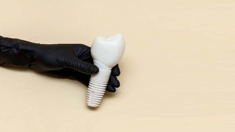 قیمت ایمپلنت اصفهان | بهترین ایمپلنت اصفهان | ایمپلنت دندان سوئیسی در اصفهان | 7 شرط برای انجام ایمپلنت یک روزه