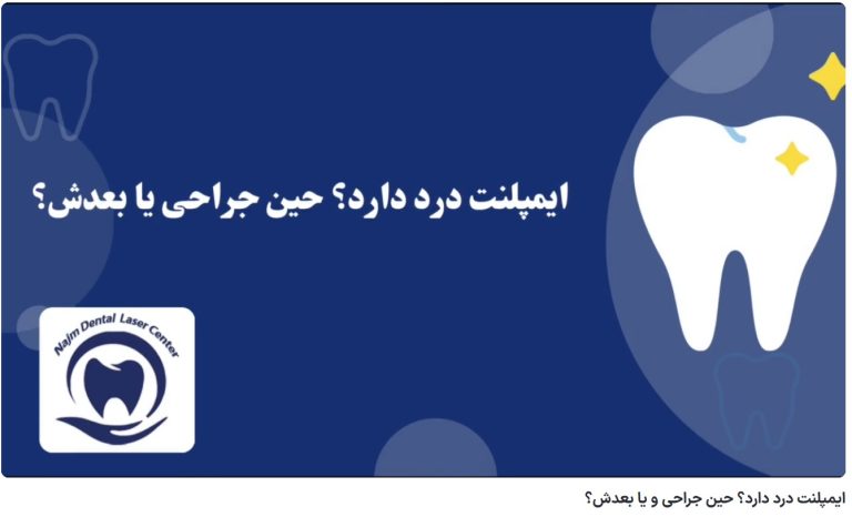 قیمت ایمپلنت اصفهان | بهترین ایمپلنت اصفهان | ایمپلنت دندان سوئیسی در اصفهان | ایمپلنت درد دارد؟ حین جراحی و یا بعدش؟ دکتر حسین برجیان، بهترین متخصص ایمپلنت اصفهان، تلفن تماس: 09138690321