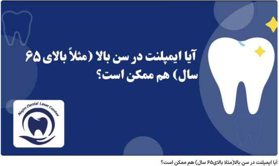 قیمت ایمپلنت اصفهان | بهترین ایمپلنت اصفهان | ایمپلنت دندان سوئیسی در اصفهان | آیا ایمپلنت در سن بالا(مثلا بالای65 سال) هم ممکن است؟ دکتر حسین برجیان، بهترین متخصص ایمپلنت اصفهان، تلفن تماس: 09138690321