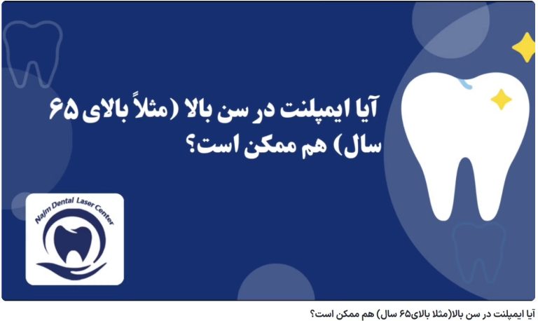 قیمت ایمپلنت اصفهان | بهترین ایمپلنت اصفهان | ایمپلنت دندان سوئیسی در اصفهان | آیا ایمپلنت در سن بالا(مثلا بالای65 سال) هم ممکن است؟ دکتر حسین برجیان، بهترین متخصص ایمپلنت اصفهان، تلفن تماس: 09138690321
