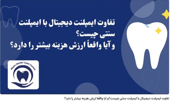 قیمت ایمپلنت اصفهان | بهترین ایمپلنت اصفهان | ایمپلنت دندان سوئیسی در اصفهان | تفاوت ایمپلنت دیجیتال با ایمپلنت سنتی چیست؟و آیا واقعا ارزش هزینه بیشتر را دارد؟ دکتر حسین برجیان، بهترین متخصص ایمپلنت اصفهان، تلفن تماس: 09138690321