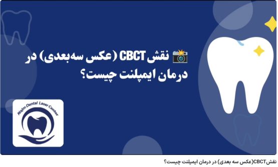 قیمت ایمپلنت اصفهان | بهترین ایمپلنت اصفهان | ایمپلنت دندان سوئیسی در اصفهان | نقشCBCT(عکس سه بعدی) در درمان ایمپلنت چیست؟ دکتر حسین برجیان، بهترین متخصص ایمپلنت اصفهان، تلفن تماس: 09138690321