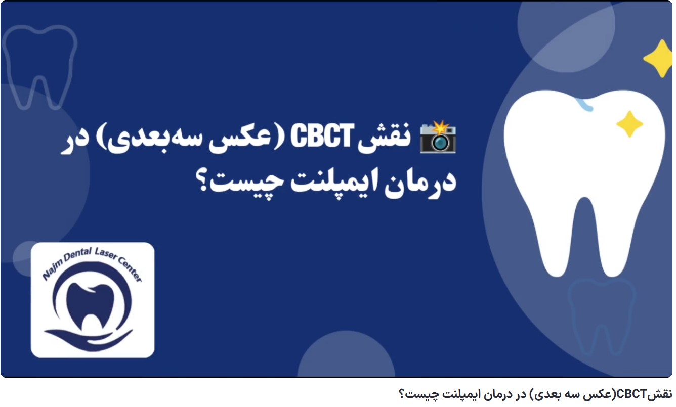 قیمت ایمپلنت اصفهان | بهترین ایمپلنت اصفهان | ایمپلنت دندان سوئیسی در اصفهان | نقشCBCT(عکس سه بعدی) در درمان ایمپلنت چیست؟ دکتر حسین برجیان، بهترین متخصص ایمپلنت اصفهان، تلفن تماس: 09138690321