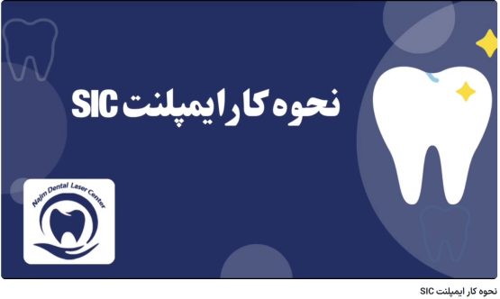 قیمت ایمپلنت اصفهان | بهترین ایمپلنت اصفهان | ایمپلنت دندان سوئیسی در اصفهان | نحوه کار ایمپلنت SIC دکتر حسین برجیان،بهترین متخصص ایمپلنت اصفهان،تلفن تماس: 09138690321