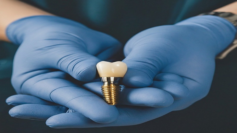 قیمت ایمپلنت اصفهان | بهترین ایمپلنت اصفهان | ایمپلنت دندان سوئیسی در اصفهان | علائم و نشانه‌های نیاز به تعویض روکش ایمپلنت