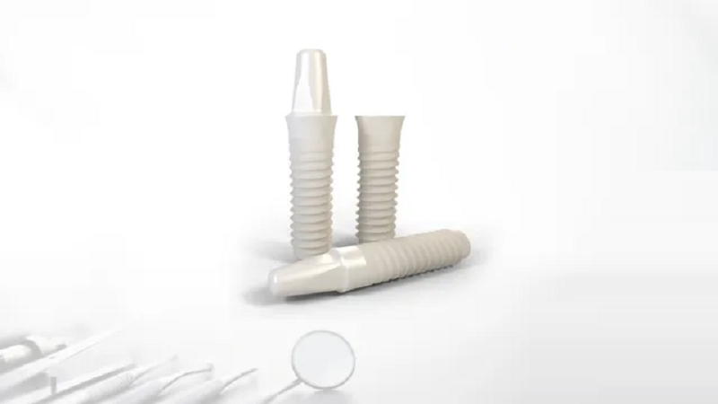 قیمت ایمپلنت اصفهان | بهترین ایمپلنت اصفهان | ایمپلنت دندان سوئیسی در اصفهان |
. قیمت کاشت ایمپلنت سرامیکی