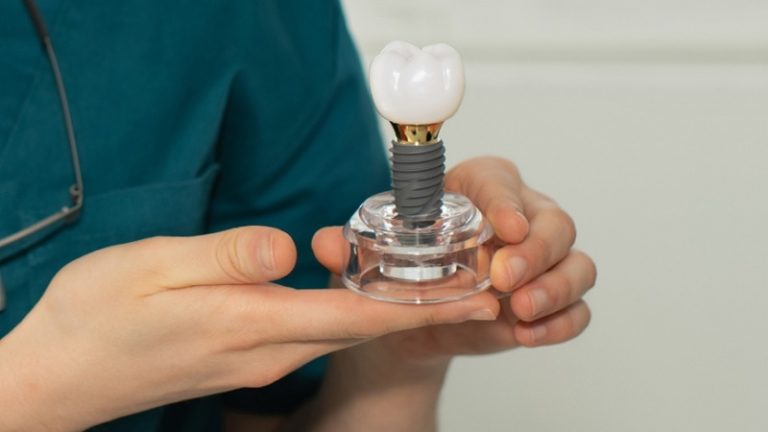 قیمت ایمپلنت اصفهان | بهترین ایمپلنت اصفهان | ایمپلنت دندان سوئیسی در اصفهان | مراقبت های لازم بعد از نصب روکش ایمپلنت دندان