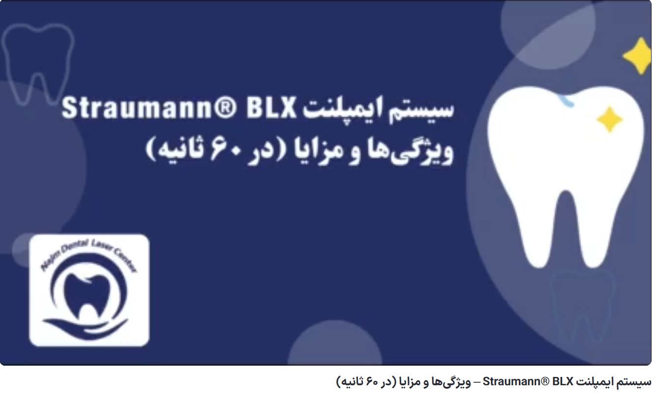 سیستم ایمپلنت Straumann® BLX – ویژگیها و مزایا (در ۶۰ ثانیه) دکتر حسین برجیان،بهترین متخصص ایمپلنت اصفهان،تلفن تماس: 09138690321