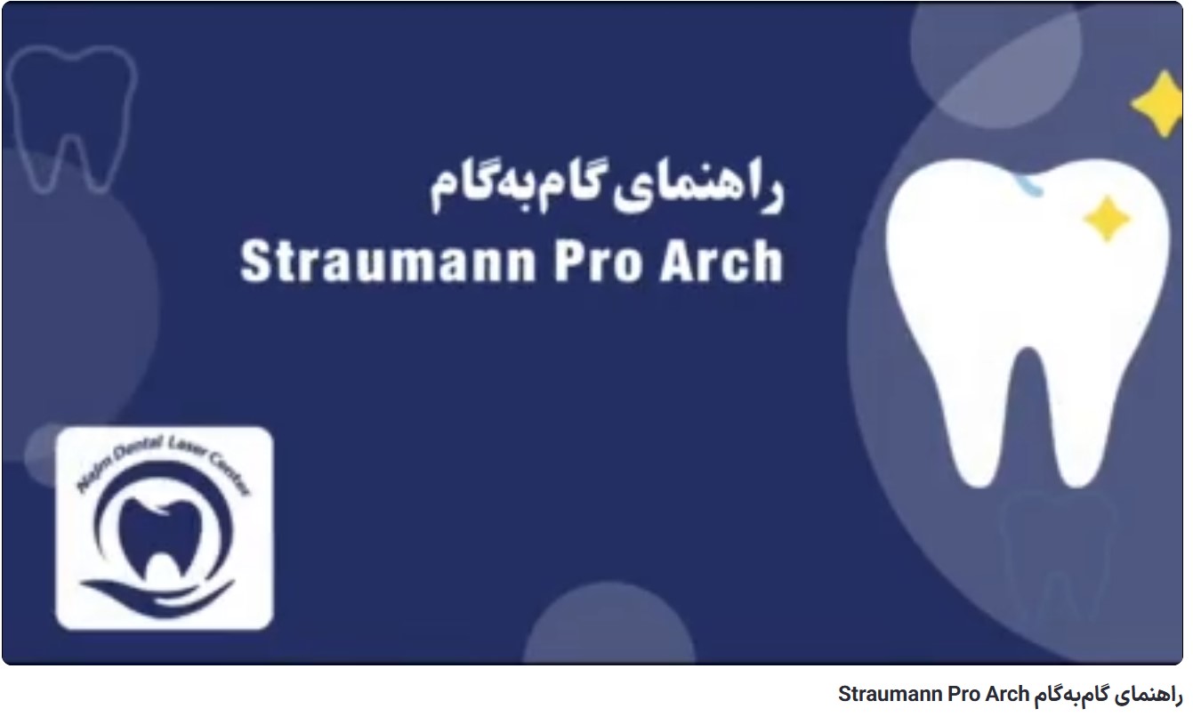 راهنمای گام‌به‌گام Straumann Pro Arch دکتر حسین برجیان،بهترین متخصص ایمپلنت اصفهان،تلفن تماس: 09138690321