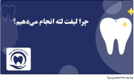چرا لیفت لثه انجام می‌دیم؟ دکتر حسین برجیان،بهترین متخصص ایمپلنت اصفهان،تلفن تماس: 09138690321