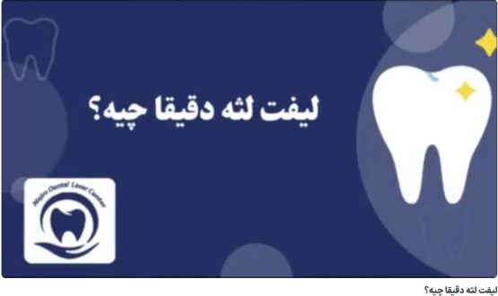 لیفت لثه دقیقا چیه؟ دکتر حسین برجیان،بهترین متخصص ایمپلنت اصفهان،تلفن تماس: 09138690321