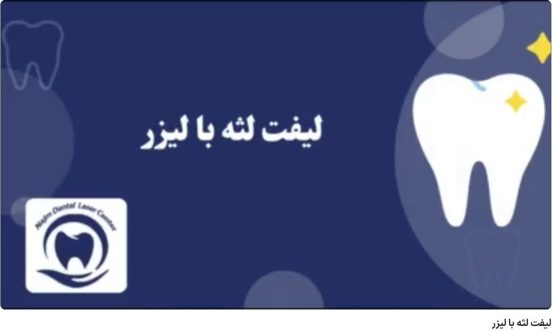 لیفت لثه با لیزر دکتر حسین برجیان،بهترین متخصص ایمپلنت اصفهان،تلفن تماس: 09138690321