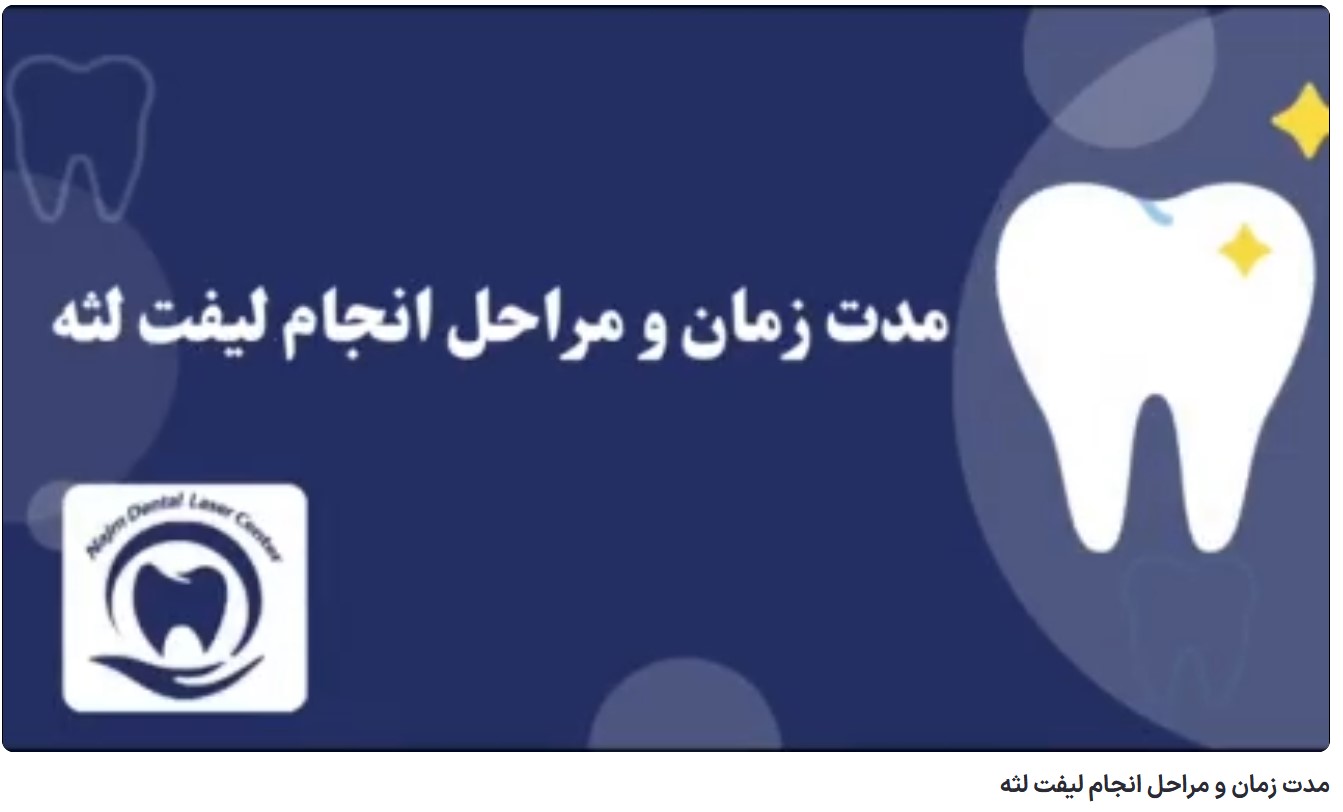 مدت زمان و مراحل انجام لیفت لثه دکتر حسین برجیان،بهترین متخصص ایمپلنت اصفهان،تلفن تماس: 09138690321