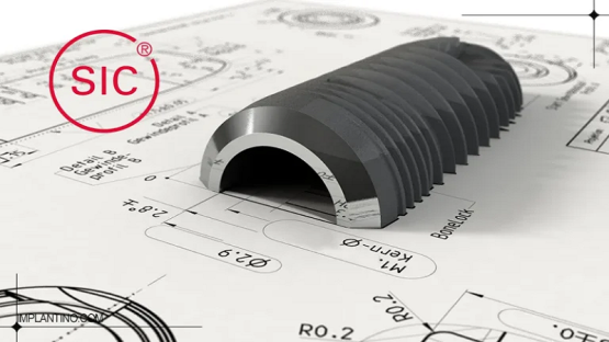 قیمت ایمپلنت اصفهان | بهترین ایمپلنت اصفهان | ایمپلنت دندان سوئیسی در اصفهان | چرا انتخاب ایمپلنت SIC سوئیسی هوشمندانه است؟
