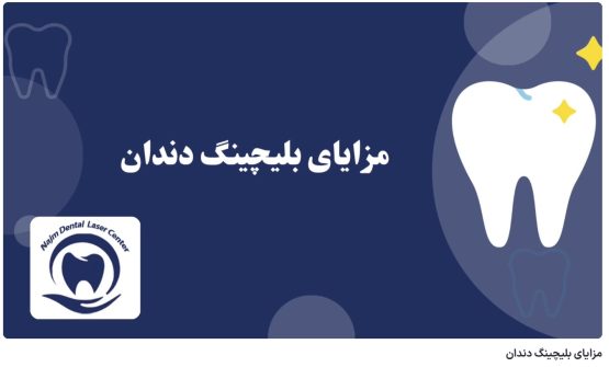 ویدئو آپارات مزایای بلیچینگ دندان