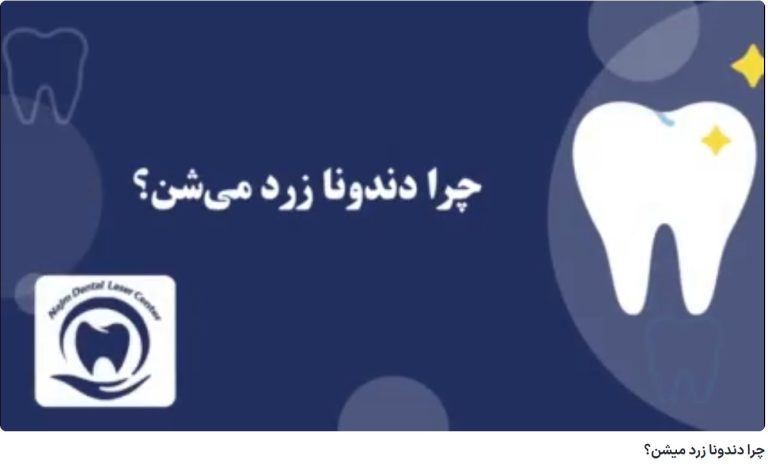 چرا دندونا زرد میشن؟ دکتر حسین برجیان،بهترین متخصص ایمپلنت اصفهان،تلفن تماس: 09138690321