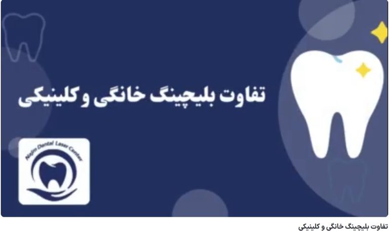 تفاوت بلیچینگ خانگی و کلینیکی دکتر حسین برجیان،بهترین متخصص ایمپلنت اصفهان،تلفن تماس: 09138690321