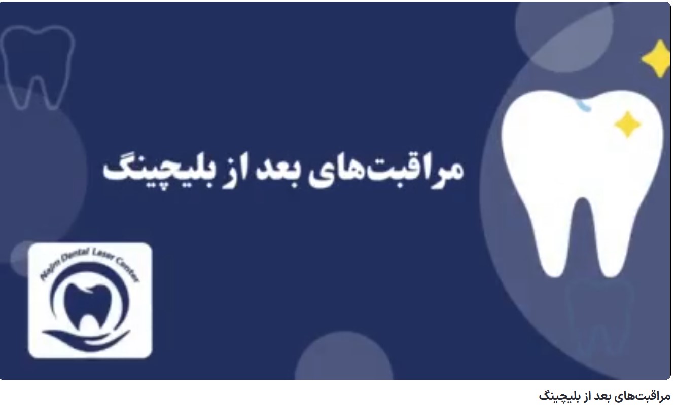 مراقبتهای بعد از بلیچینگ دکتر حسین برجیان،بهترین متخصص ایمپلنت اصفهان،تلفن تماس: 09138690321