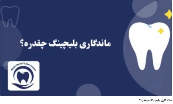 ماندگاری بلیچینگ چقدره؟ دکتر حسین برجیان،بهترین متخصص ایمپلنت اصفهان،تلفن تماس: 09138690321
