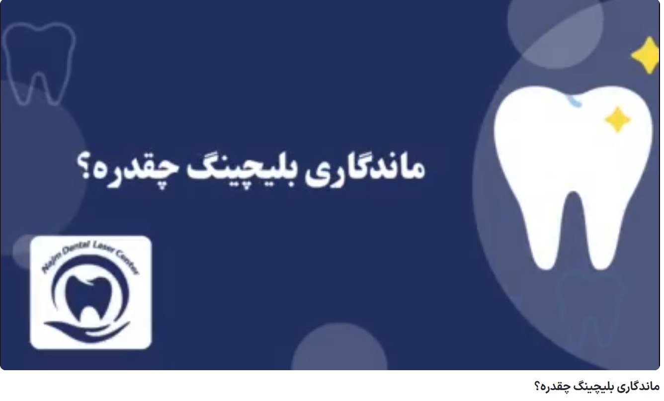ماندگاری بلیچینگ چقدره؟ دکتر حسین برجیان،بهترین متخصص ایمپلنت اصفهان،تلفن تماس: 09138690321