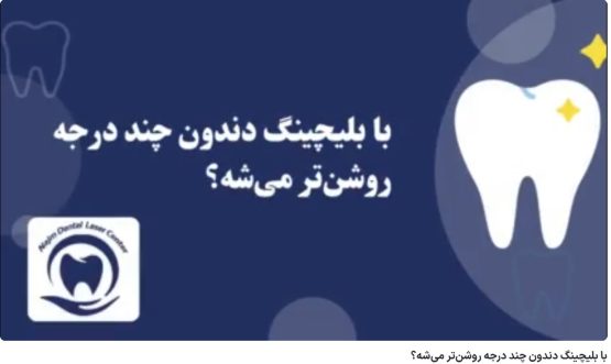 با بلیچینگ دندون چند درجه روشن‌تر می‌شه؟ دکتر حسین برجیان،بهترین متخصص ایمپلنت اصفهان،تلفن تماس: 09138690321