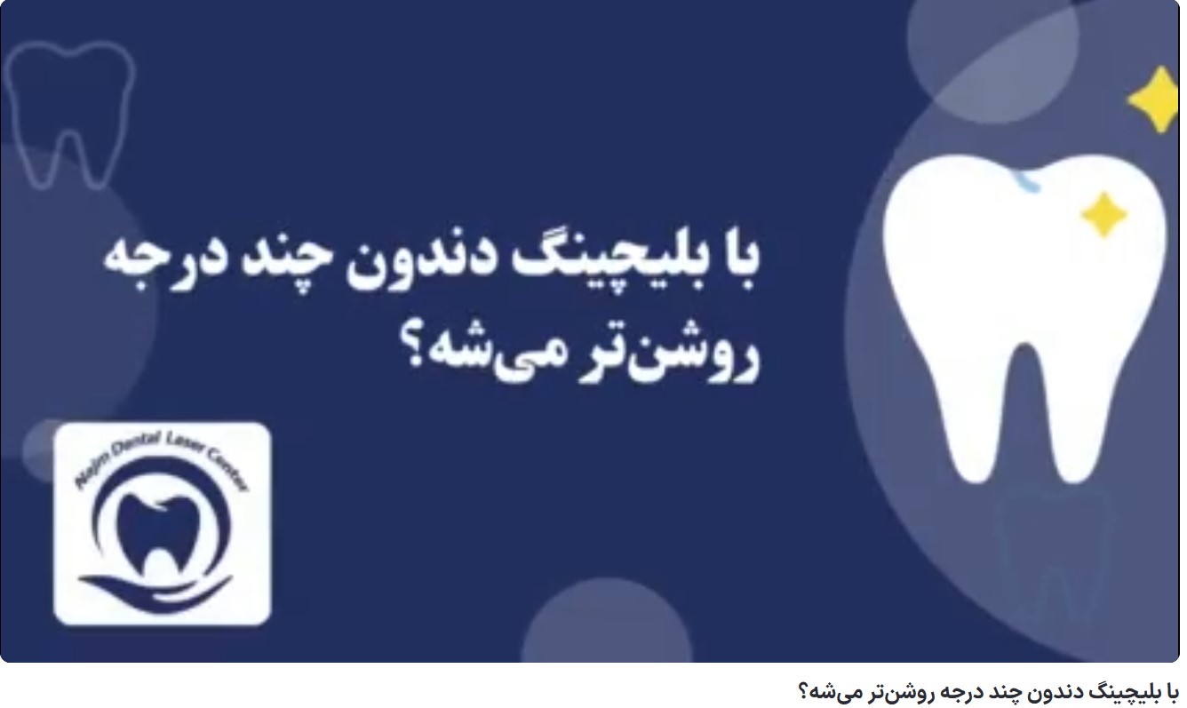 با بلیچینگ دندون چند درجه روشن‌تر می‌شه؟ دکتر حسین برجیان،بهترین متخصص ایمپلنت اصفهان،تلفن تماس: 09138690321