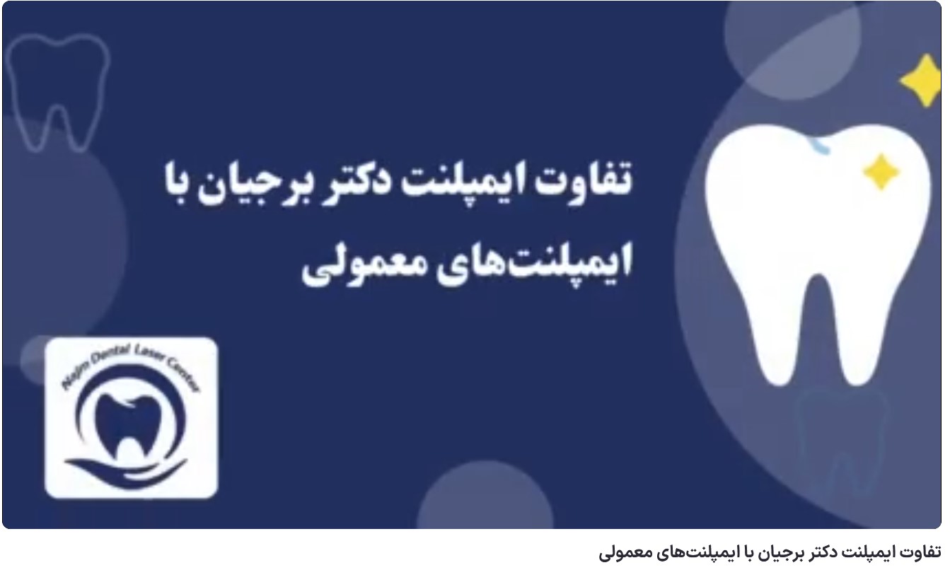 تفاوت ایمپلنت دکتر برجیان با ایمپلنتهای معمولی دکتر حسین برجیان،بهترین متخصص ایمپلنت اصفهان،تلفن تماس: 09138690321