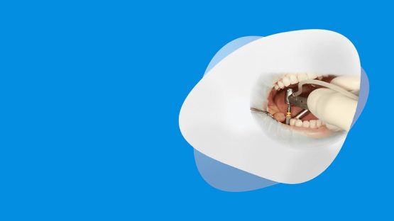 قیمت ایمپلنت اصفهان | بهترین ایمپلنت اصفهان | ایمپلنت دندان سوئیسی در اصفهان | جراحی لثه برای ایمپلنت دندان برای چه افرادی انجام می شود ؟